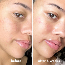 Cargar imagen en el visor de la galería, VITAMIN C-BRIGHT PUTTY PRIMER